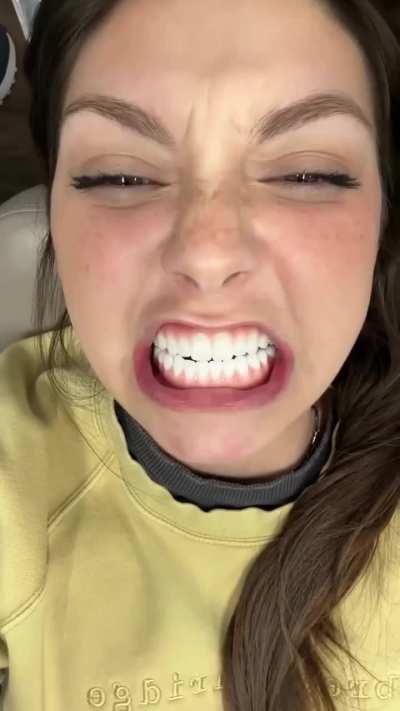 She gets a full set of dental implants