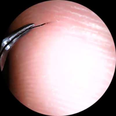 I had never had a hair splinter before this year. Two dogs and a hardwood floor have changed that.