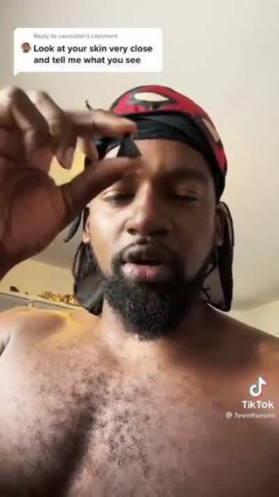 Our Skin Is A Pyramid Scheme 😱😱😱