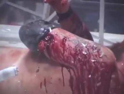 NSFL cut during wrestling match.