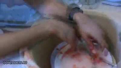 WCGW putting a firecracker in a glass container