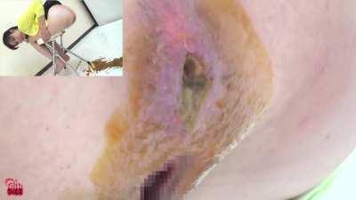 Girl Japanese with diarrhea #35