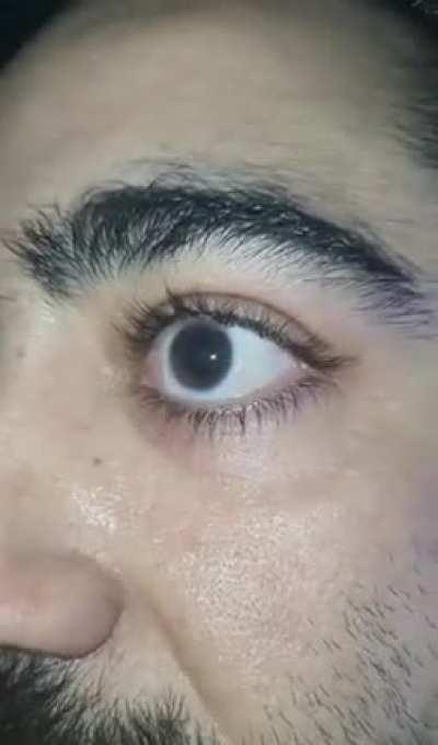 Took some pretty shady MDMA this weekend that was spiked with who knows what and my eyes couldn’t stay still