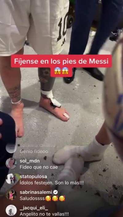 Messi tiene pie plano