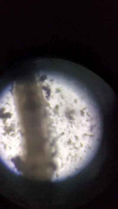 What's this white/clear worm