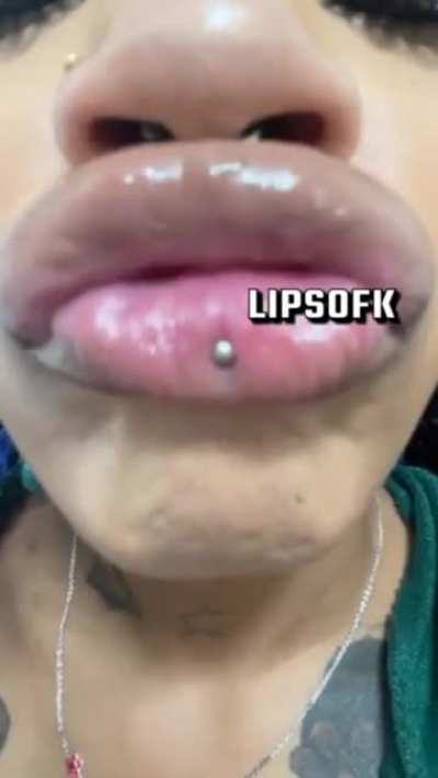 Lipsofk again