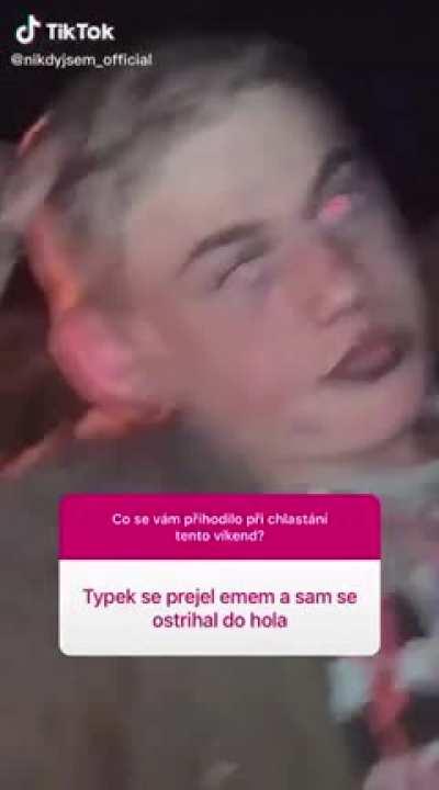 Guy on mdma cut all his hair with scissors