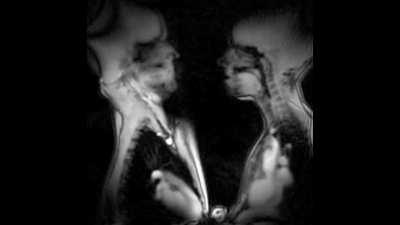 thanks I hate Kissing in MRI