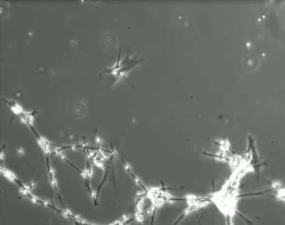 Brain cells in culture trying to form new connection