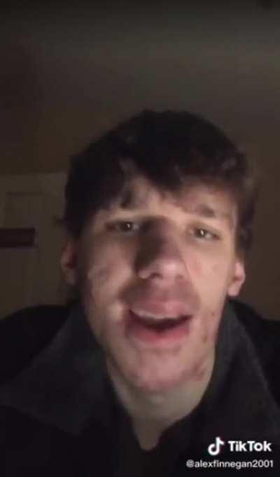 This still makes me cringe most. 🤢