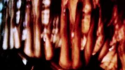 I need this bro ♦️♦️♦️