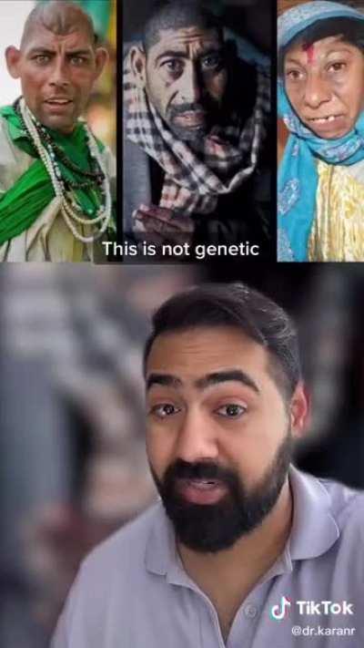 The rat children in Pakistan. I hope it's not true...