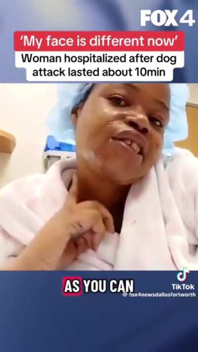 Oak Cliff woman describes brutal pit bull attack after 5 days in hospital