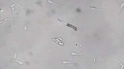 A nanobot picks up a lazy sperm by the tail and inseminates an egg with it