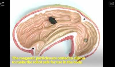 Nanorobot - the future is now