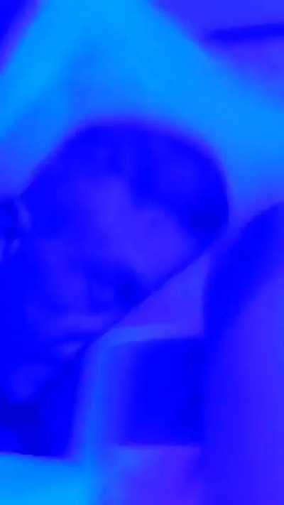 Taboritsky thigh crushing