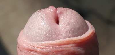 Peel me slowly