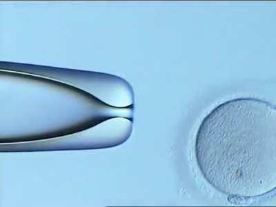 A Person Being Conceived | IVF