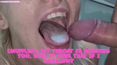 Would you try this new burn cream?