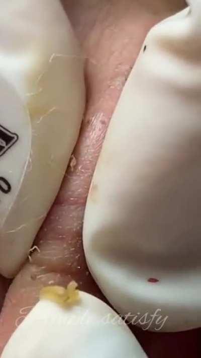 Watch for a surprise