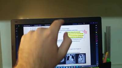 Finalizing my Cat-Scan results