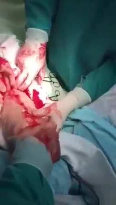 Dude was too horny for his own good (Bloody surgery warning)