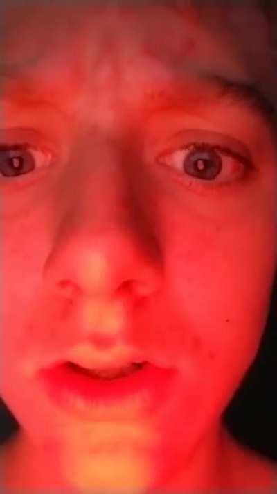 comedyepilepsy - Video #7982