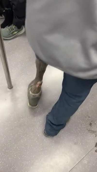 You might wanna get that checked out. NSFW