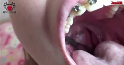 Girl Swallows A Frog Alive