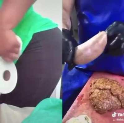 Thanks, I hate sausages