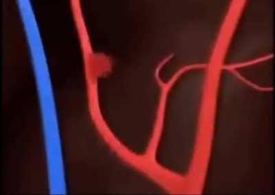 Wanna break from the aaurghh?