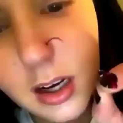 HMC while I remove my piercing