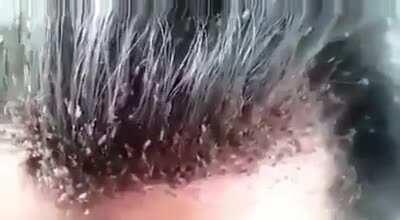 A Lice civilization on this person's head