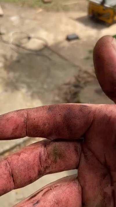 A splinter went through my finger into the other stitching them together.