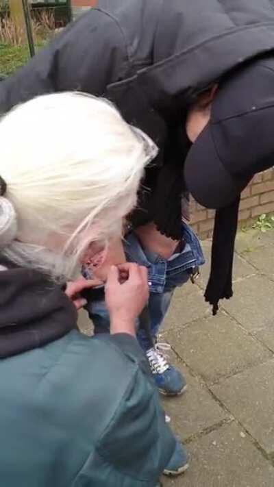 Dog bite during riots in Amsterdam