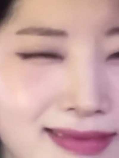 DAHYUN 💕