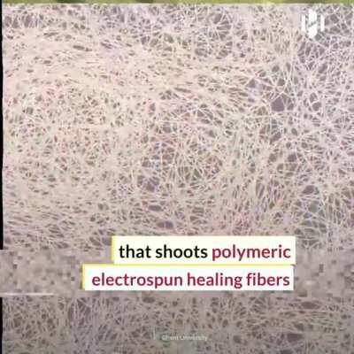New spider-man-style medical gun can help treat burns and serious injuries by spraying electrospun healing nanofibers