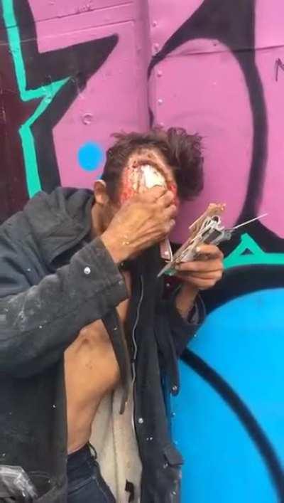 Man cutting off flesh from his skull in Mexico