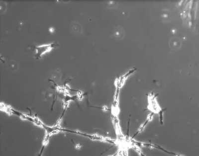 Células cerebrais em um prato de cultura tentando formar conexões entre si