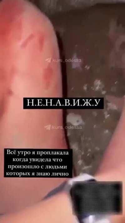 After the night shelling of Sergiivka, Odessa region.