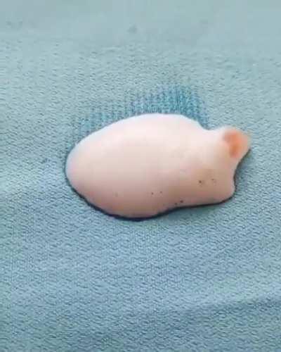 Hydrogen Peroxide helps remove stains in one go...