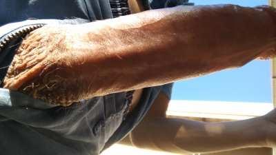 Getting Some Vitamin D, Pun Intended😋😉