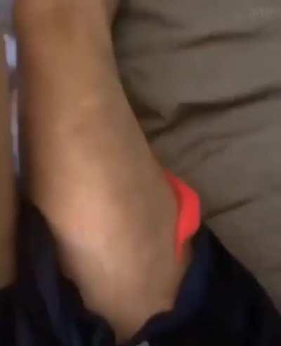 Thanks, I hate worms