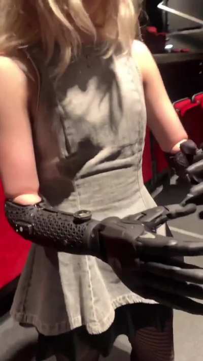 Wireless Bionic Prosthetics By Open Bionics