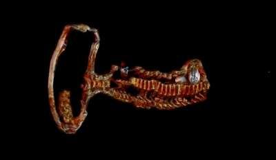 Full Body CT Scan of Josefina [Part #1]