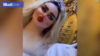 This woman got 43 surgeries to look like Barbie