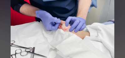 Huge splinter stuck in toddlers foot