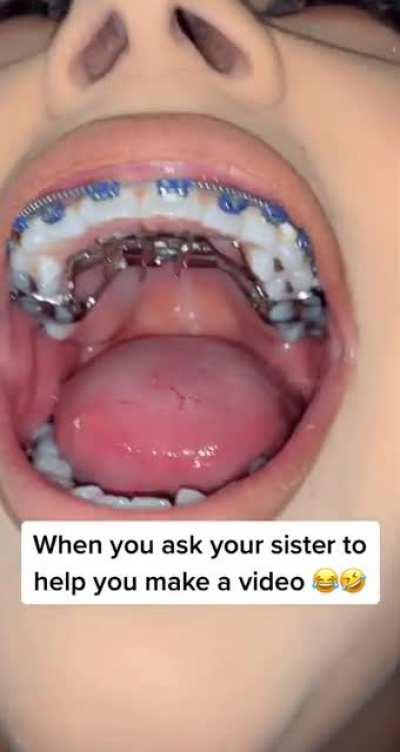 That moment when the nose filter disappeared...