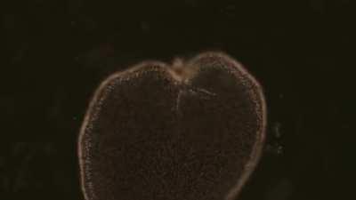 Planarian Growing A Full Body At Ease!