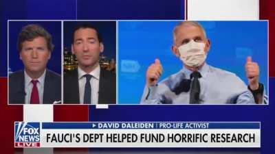 Dr Fauci’s NIAID purchased severed heads of aborted babies and grafted their scalps onto lab rats